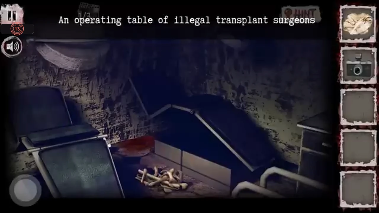 Close-up of the operating table with a pile of bloody bones on the tray